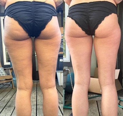 Photo cliente avant et après