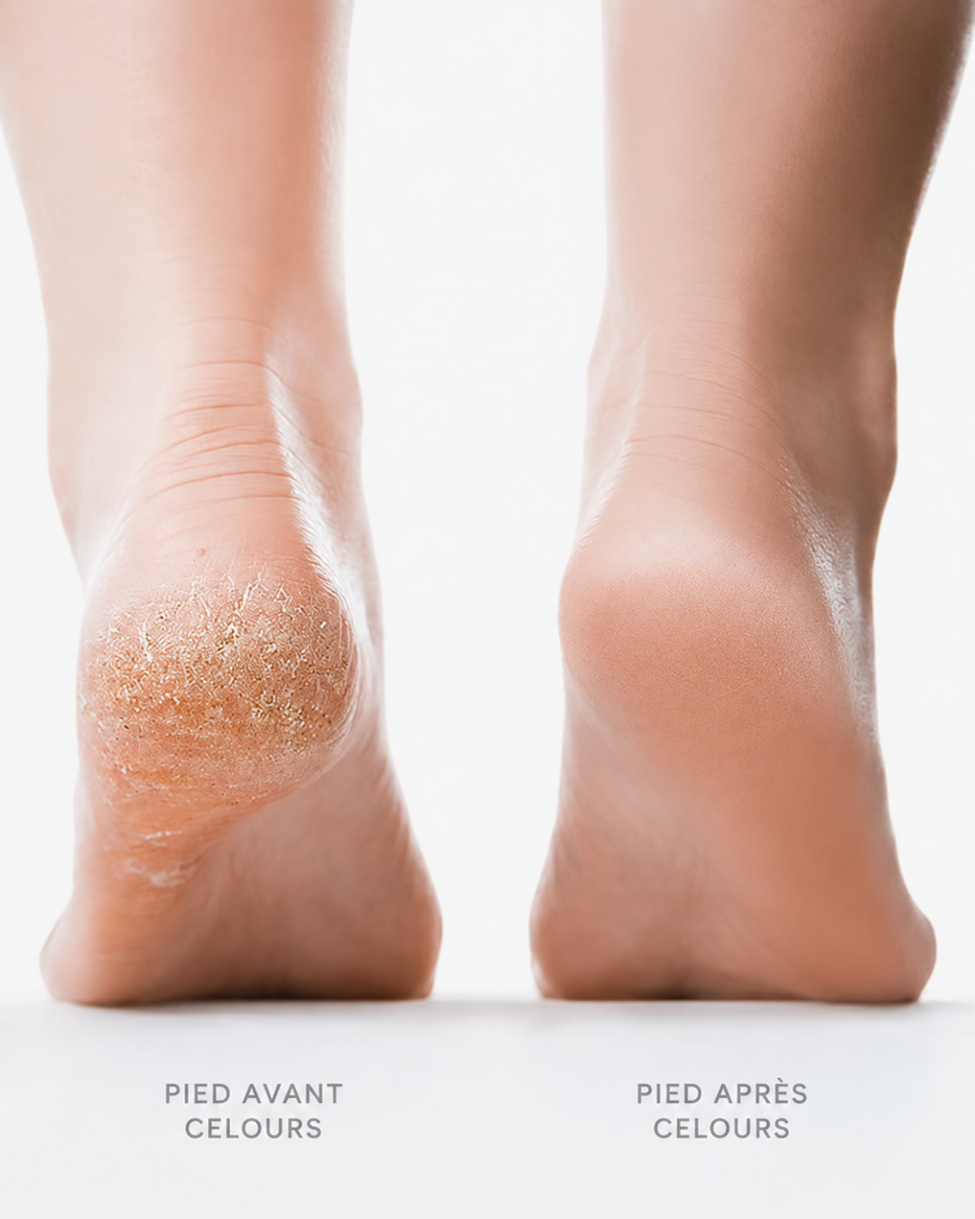 Celours SmoothPro™