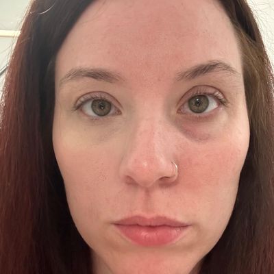 Résultat client Eclateyes
